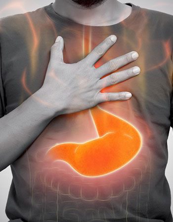 GERD and acid reflux treatment by gastroenterologist in Vijayawada